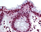 Immunohistochemistry (Formalin/PFA-fixed paraffin-embedded sections) - Anti-TR150 antibody (AB71985)