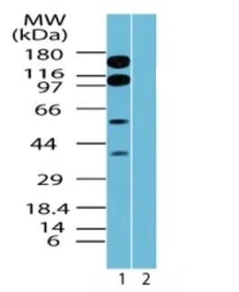 Western blot - Anti-TR150 antibody (AB71985)