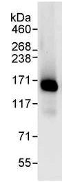 Immunoprecipitation - Anti-TR150 antibody (AB72455)