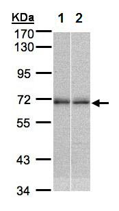 Western blot - Anti-TR4 antibody (AB137582), expandable thumbnail