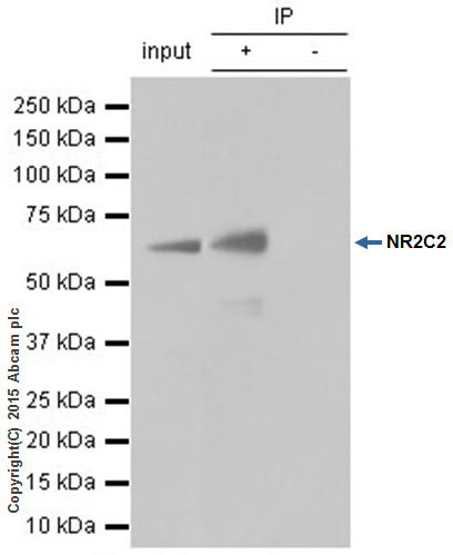 Immunoprecipitation - Anti-TR4 antibody [EPR1773(2)] - BSA and Azide free (AB247826), expandable thumbnail