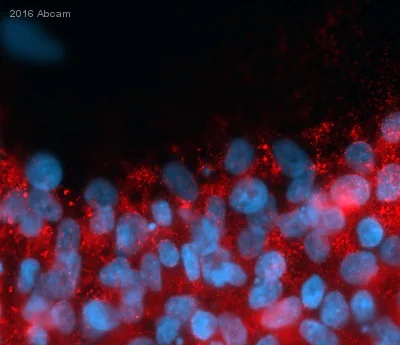Immunocytochemistry - Anti-TRA-1-60 (R) antibody [TRA-1-60] (AB16288)