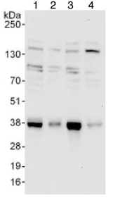 Western blot - Anti-TRA2A antibody (AB138448)