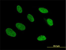 Immunocytochemistry/ Immunofluorescence - Anti-TRA2A antibody (AB169052)