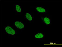Immunocytochemistry/ Immunofluorescence - Anti-TRA2A antibody (AB169052)