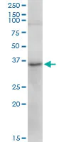 Western blot - Anti-TRA2A antibody (AB169052)
