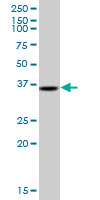 Western blot - Anti-TRA2A antibody (AB169052)