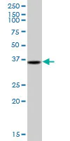 Western blot - Anti-TRA2A antibody (AB169052)