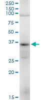 Western blot - Anti-TRA2A antibody (AB169052)