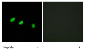Immunocytochemistry/ Immunofluorescence - Anti-TRA2A antibody (AB72625), expandable thumbnail