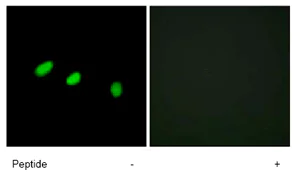 Immunocytochemistry/ Immunofluorescence - Anti-TRA2A antibody (AB72625)