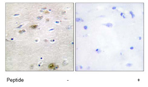Immunohistochemistry (Formalin/PFA-fixed paraffin-embedded sections) - Anti-TRA2A antibody (AB72625), expandable thumbnail