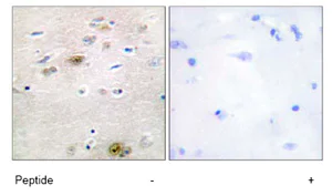 Immunohistochemistry (Formalin/PFA-fixed paraffin-embedded sections) - Anti-TRA2A antibody (AB72625)