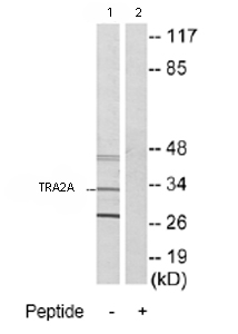 Western blot - Anti-TRA2A antibody (AB72625), expandable thumbnail