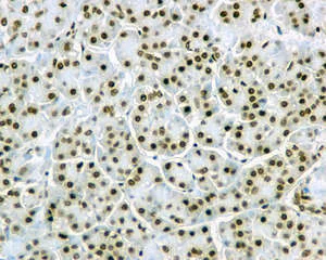 Immunohistochemistry (Formalin/PFA-fixed paraffin-embedded sections) - Anti-TRA2B/SFRS10 antibody [EPR11831] (AB171082)