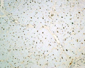 Immunohistochemistry (Formalin/PFA-fixed paraffin-embedded sections) - Anti-TRA2B/SFRS10 antibody [EPR11831] (AB171082)