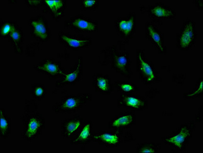 Immunocytochemistry/ Immunofluorescence - Anti-TRADD antibody (AB223040), expandable thumbnail