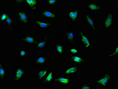 Immunocytochemistry/ Immunofluorescence - Anti-TRADD antibody (AB223040)