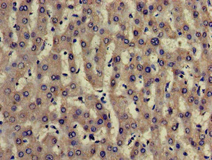 Immunohistochemistry (Formalin/PFA-fixed paraffin-embedded sections) - Anti-TRADD antibody (AB223040)