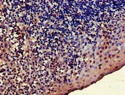 Immunohistochemistry (Formalin/PFA-fixed paraffin-embedded sections) - Anti-TRADD antibody (AB223040)