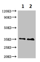Western blot - Anti-TRADD antibody (AB223040), expandable thumbnail