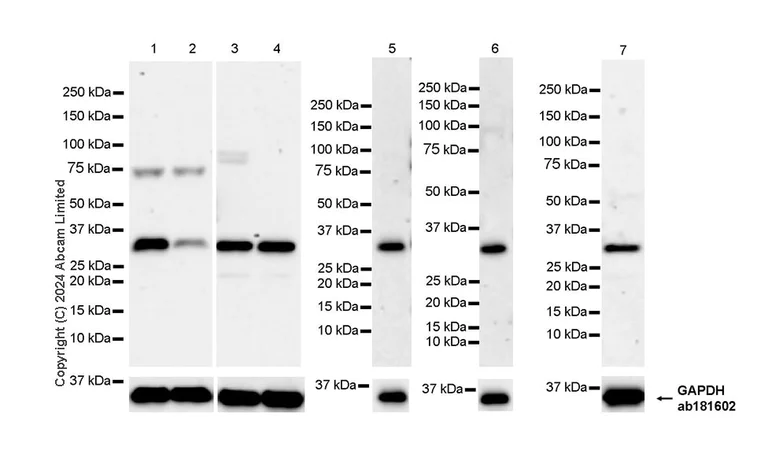 Western blot - Anti-TRADD antibody [EPR27061-75] - BSA and Azide free (AB319030)
