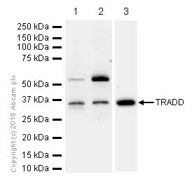 Western blot - Anti-TRADD antibody [EPR3604] (AB110644)