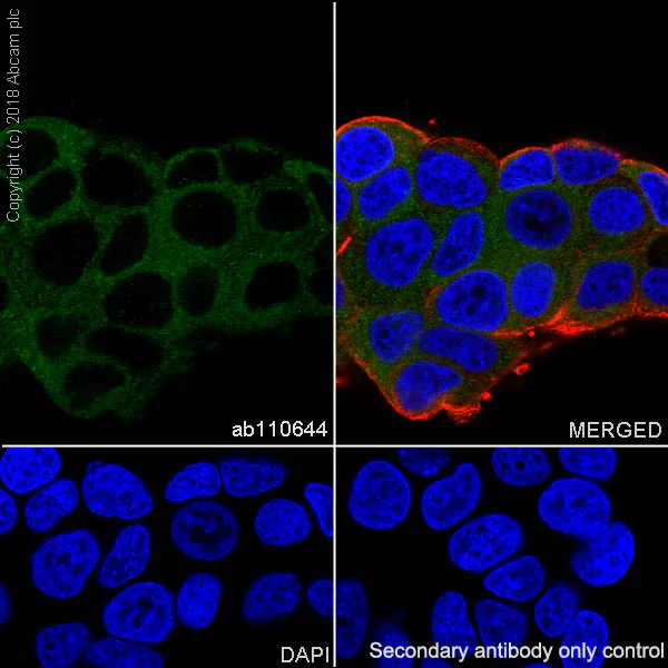 Immunocytochemistry/ Immunofluorescence - Anti-TRADD antibody [EPR3604] - BSA and Azide free (AB238960)