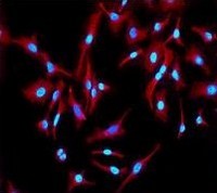Immunocytochemistry/ Immunofluorescence - Anti-TRADD antibody [EPR3604] - BSA and Azide free (AB238960)