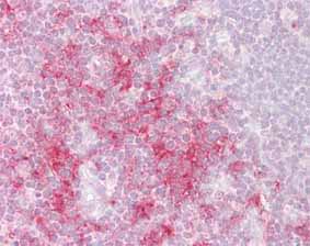 Immunohistochemistry (Formalin/PFA-fixed paraffin-embedded sections) - Anti-TRAF1 antibody (AB129279)