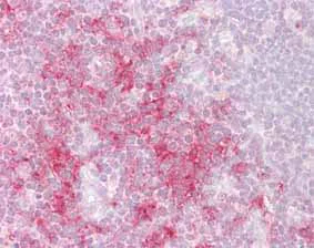 Immunohistochemistry (Formalin/PFA-fixed paraffin-embedded sections) - Anti-TRAF1 antibody (AB129279)