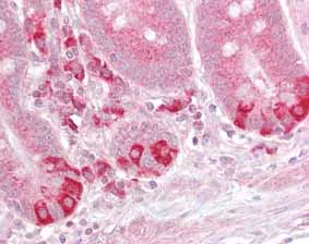 Immunohistochemistry (Formalin/PFA-fixed paraffin-embedded sections) - Anti-TRAF1 antibody (AB129279)