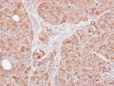 Immunohistochemistry (Formalin/PFA-fixed paraffin-embedded sections) - Anti-TRAF1 antibody (AB155268)