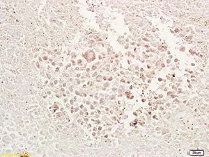 Immunohistochemistry (Formalin/PFA-fixed paraffin-embedded sections) - Anti-TRAF1 antibody (AB203316), expandable thumbnail