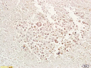 Immunohistochemistry (Formalin/PFA-fixed paraffin-embedded sections) - Anti-TRAF1 antibody (AB203316)