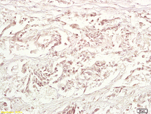 Immunohistochemistry (Formalin/PFA-fixed paraffin-embedded sections) - Anti-TRAF1 antibody (AB203316), expandable thumbnail