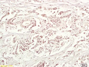 Immunohistochemistry (Formalin/PFA-fixed paraffin-embedded sections) - Anti-TRAF1 antibody (AB203316)