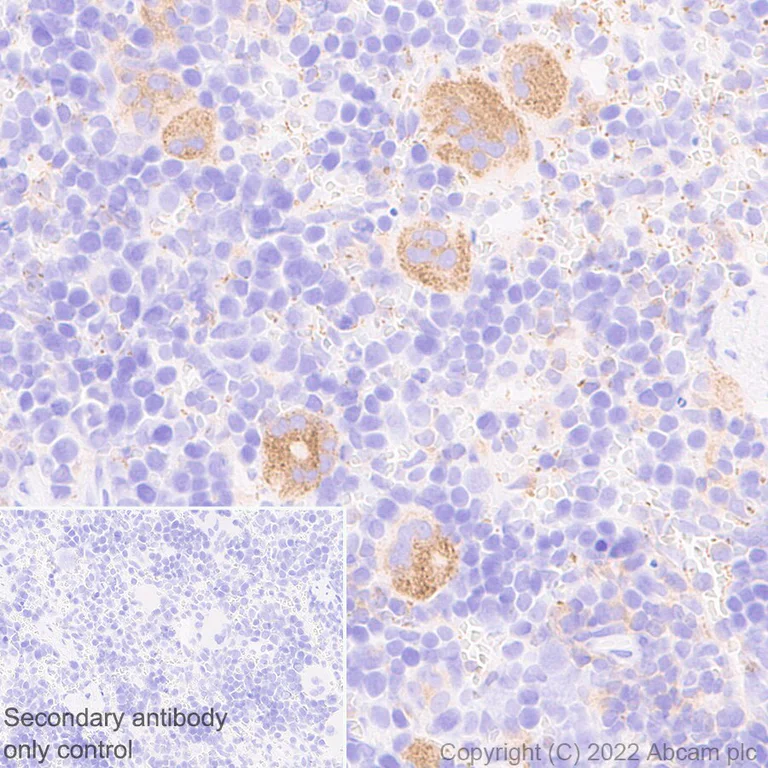 Immunohistochemistry (Formalin/PFA-fixed paraffin-embedded sections) - Anti-TRAF1 antibody [EPR26204-112] (AB300075)