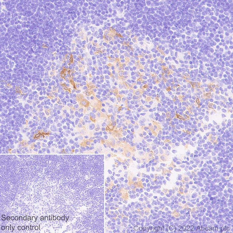 Immunohistochemistry (Formalin/PFA-fixed paraffin-embedded sections) - Anti-TRAF1 antibody [EPR26204-112] (AB300075)