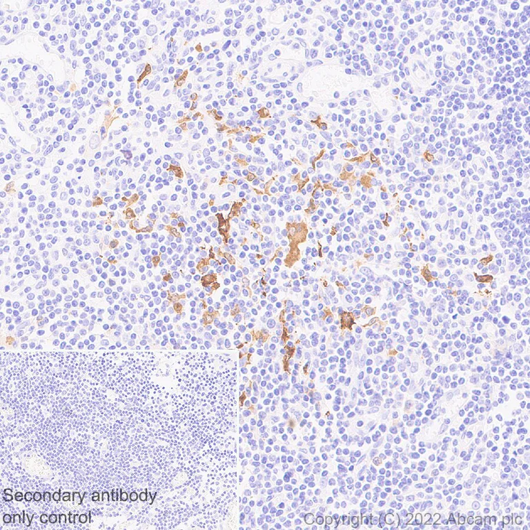 Immunohistochemistry (Formalin/PFA-fixed paraffin-embedded sections) - Anti-TRAF1 antibody [EPR26204-112] (AB300075)