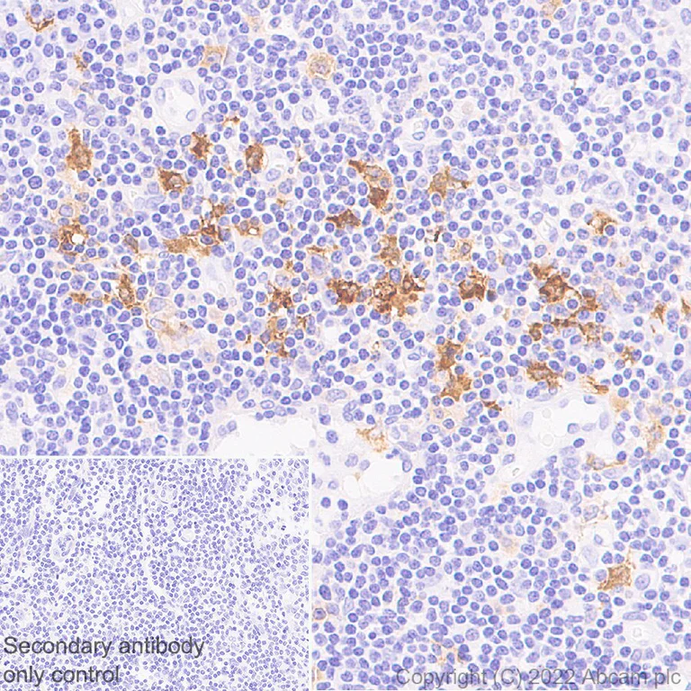 Immunohistochemistry (Formalin/PFA-fixed paraffin-embedded sections) - Anti-TRAF1 antibody [EPR26204-112] (AB300075)
