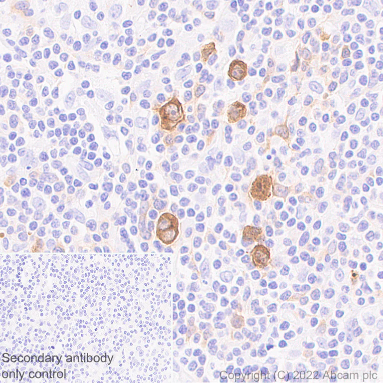 Immunohistochemistry (Formalin/PFA-fixed paraffin-embedded sections) - Anti-TRAF1 antibody [EPR26204-112] (BSA and Azide free) (AB300076)