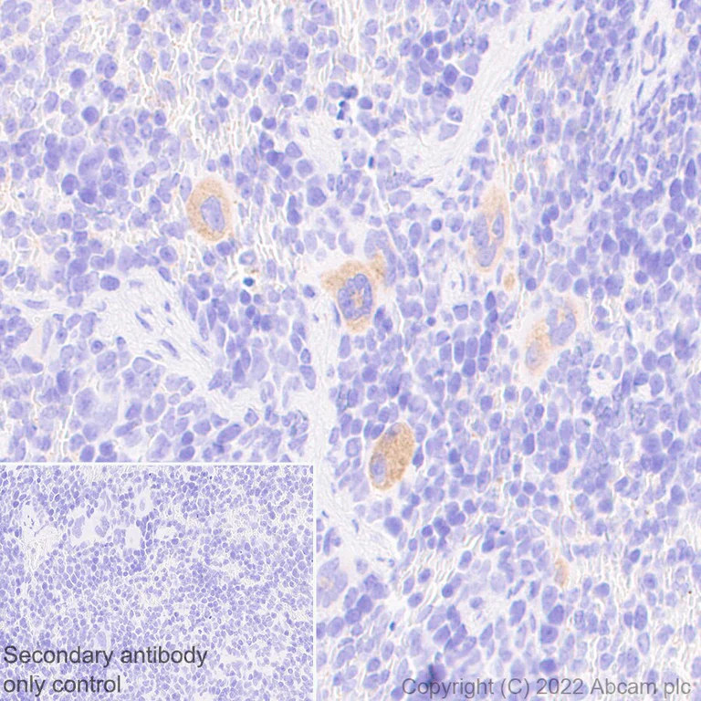 Immunohistochemistry - Anti-TRAF1 antibody [EPR26204-112] (BSA and Azide free) (AB300076)