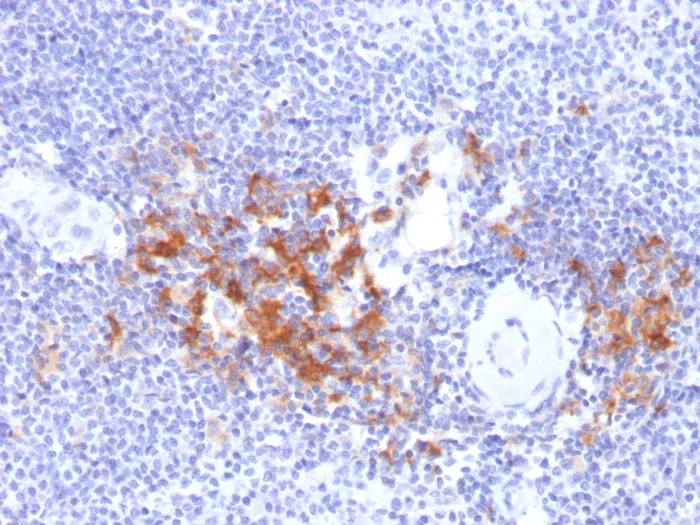 Immunohistochemistry (Formalin/PFA-fixed paraffin-embedded sections) - Anti-TRAF1 antibody [TRAF1/2770] (AB268121)