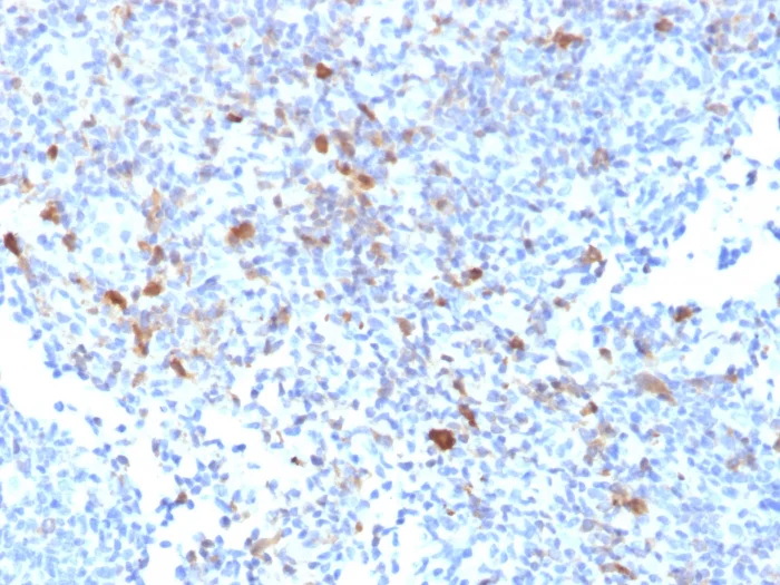 Immunohistochemistry (Formalin/PFA-fixed paraffin-embedded sections) - Anti-TRAF1 antibody [TRAF1/2770] (AB268121)