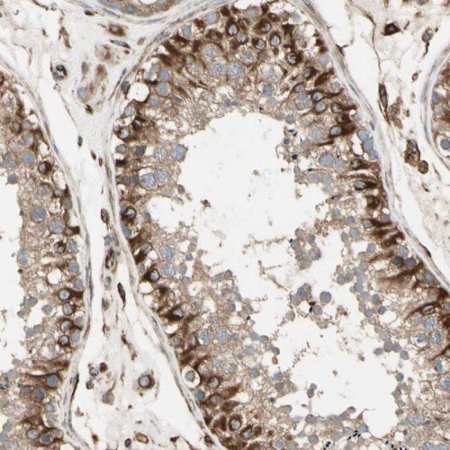 Immunocytochemistry/ Immunofluorescence - Anti-TRAF2 antibody (AB244317)