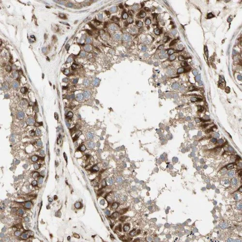Immunocytochemistry/ Immunofluorescence - Anti-TRAF2 antibody (AB244317)