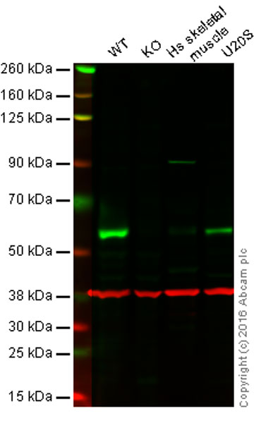 Western blot - Anti-TRAF2 antibody [EPR6048] (AB126758), expandable thumbnail
