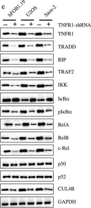 Western blot - Anti-TRAF2 antibody [EPR6048] (ab126758), expandable thumbnail