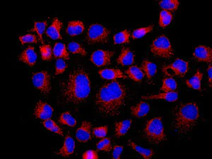 Immunocytochemistry/ Immunofluorescence - Anti-TRAF2 antibody [EPR7064] (AB167163)